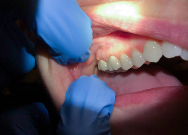 Dentist for Dental Trauma in GA